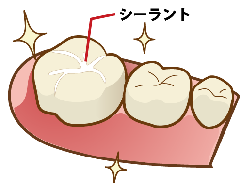 代々木クリスタル歯科医院の小児歯科